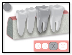 diagnose the problematic tooth diagram